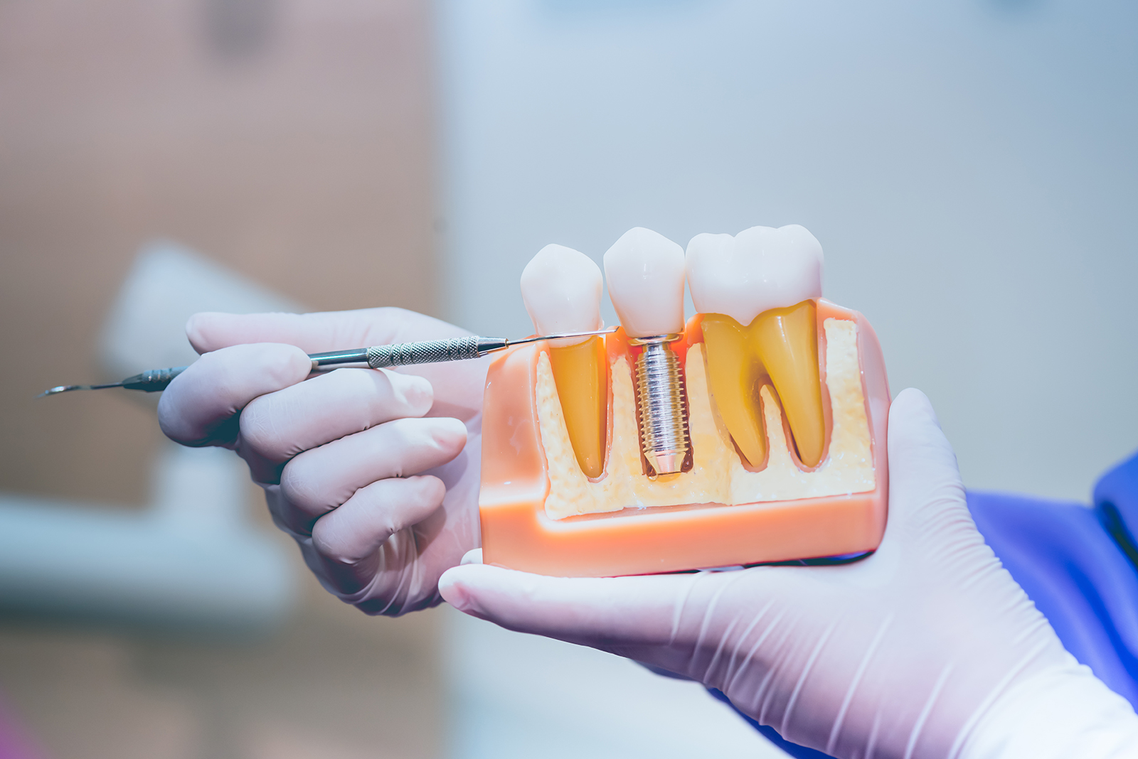 Pappas Family Dentistry | Dentures, Extractions and Night Guards