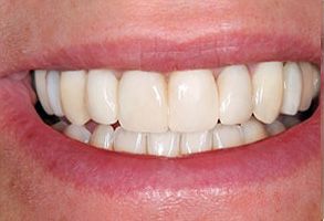 Pappas Family Dentistry | Emergency Treatment, Teeth Whitening and Dentures